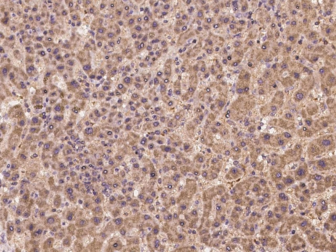 APOH / Apolipoprotein H Antibody