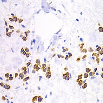 DRD1 / Dopamine Receptor D1 Antibody (aa338-446)