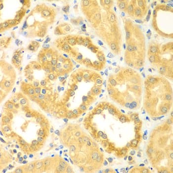 Polyclonal Rabbit anti-Human PDE4DIP / MMGL Antibody (IHC, WB)