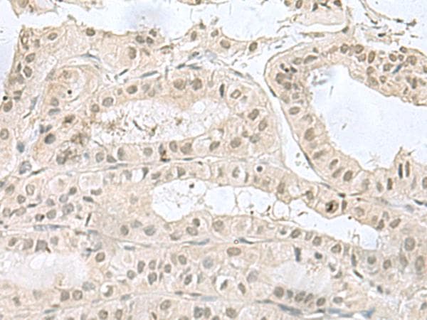 PCBD1 / PHS Antibody