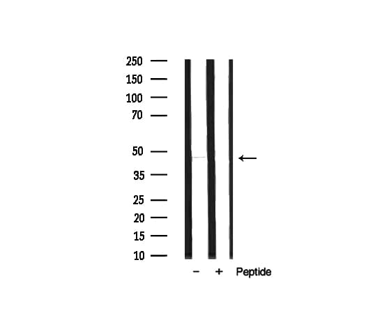 MOK / RAGE Antibody