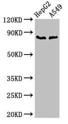 CFB / Complement Factor B Antibody