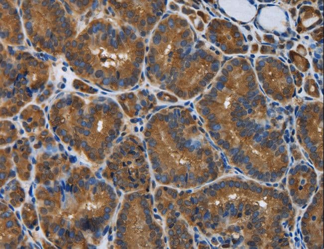 SNCG / Gamma-Synuclein Antibody