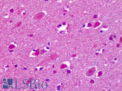 IHC-plus™ CELSR2 Antibody (C-Terminus)