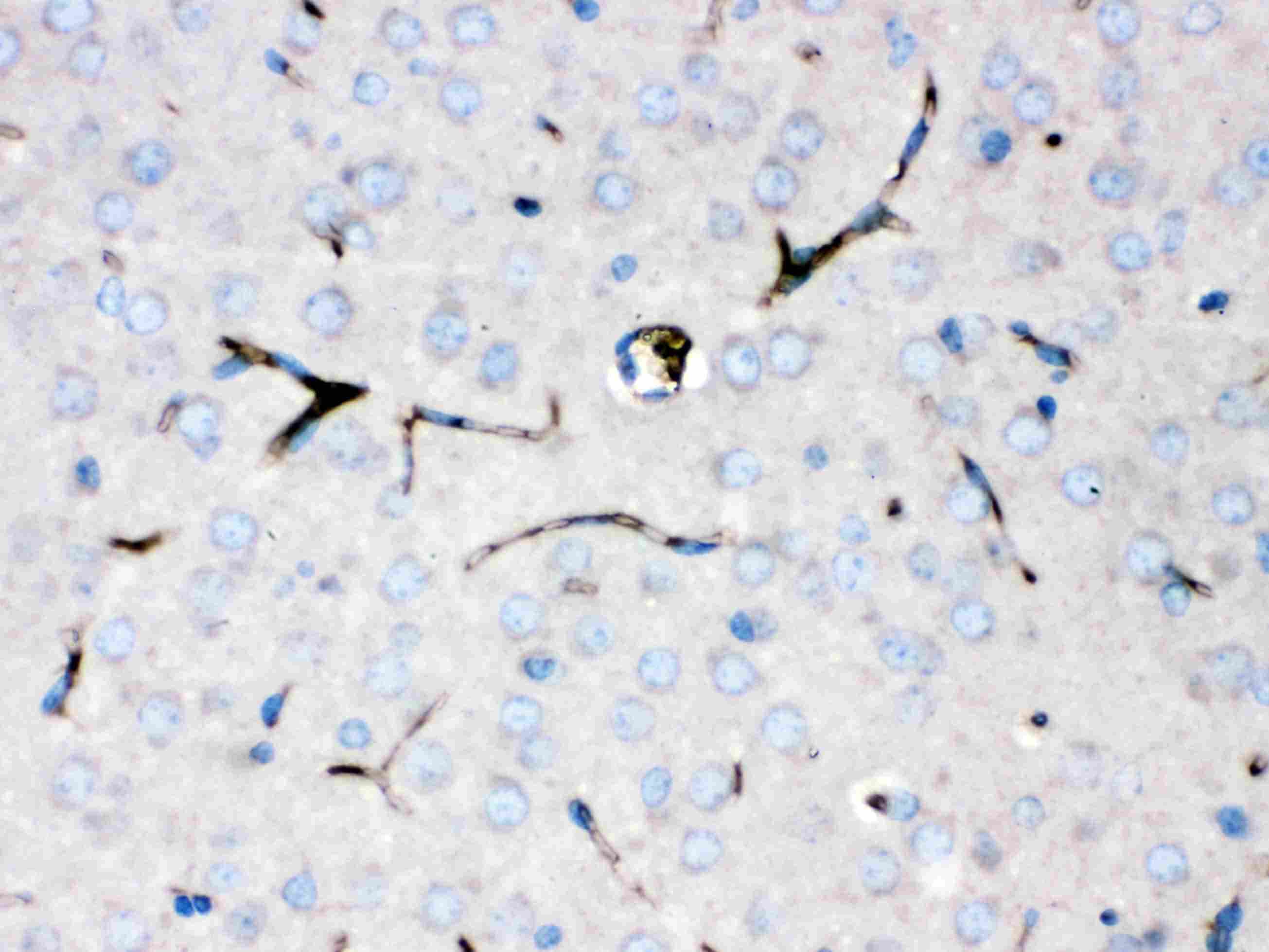 CP / Ceruloplasmin Antibody (aa20-258)