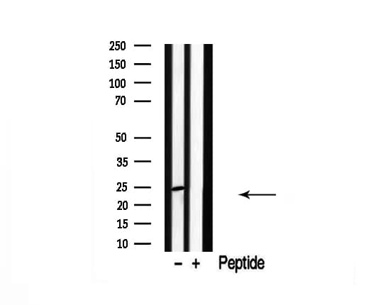 CACNG1 / CACNG Antibody