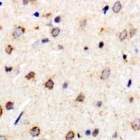 MTX1 / Metaxin 1 Antibody