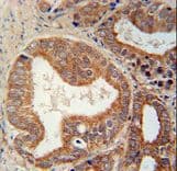 CSGALNACT1 Antibody (aa192-220)