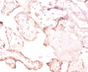 FTSJ1 Antibody