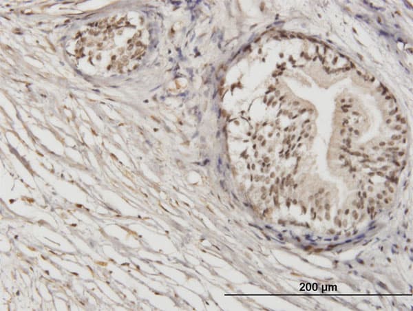 ZNF92 Antibody (clone 1F2)