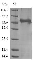 Human NCS1 / Neuronal Calcium Sensor Protein (Recombinant GST, N-terminus)