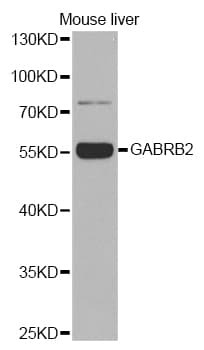 Polyclonal Rabbit anti-Human GABRB2 Antibody (IHC, WB)