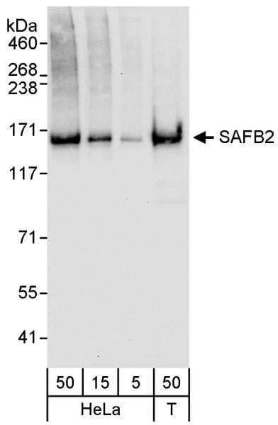 Polyclonal Rabbit anti-Human SAFB2 Antibody (aa75-125, WB)