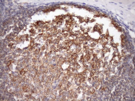 MALT1 Antibody (clone OTI4C3, Carrier-free)