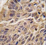 Polyclonal Rabbit anti-Human IDO1 / IDO Antibody (aa374-403, IHC, WB)