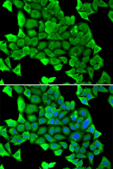 MYH1 Antibody