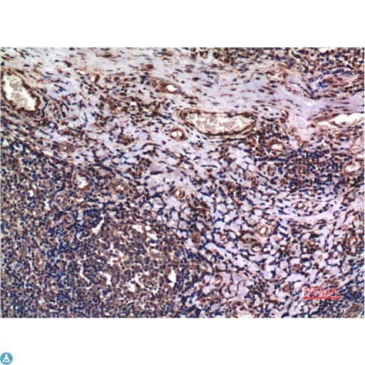 Monoclonal Mouse anti-Human CCNB1 / Cyclin B1 Antibody (IHC)