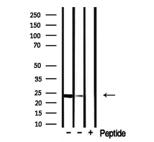 Polyclonal Rabbit anti-Human CLDN22 / Claudin 22 Antibody (WB)