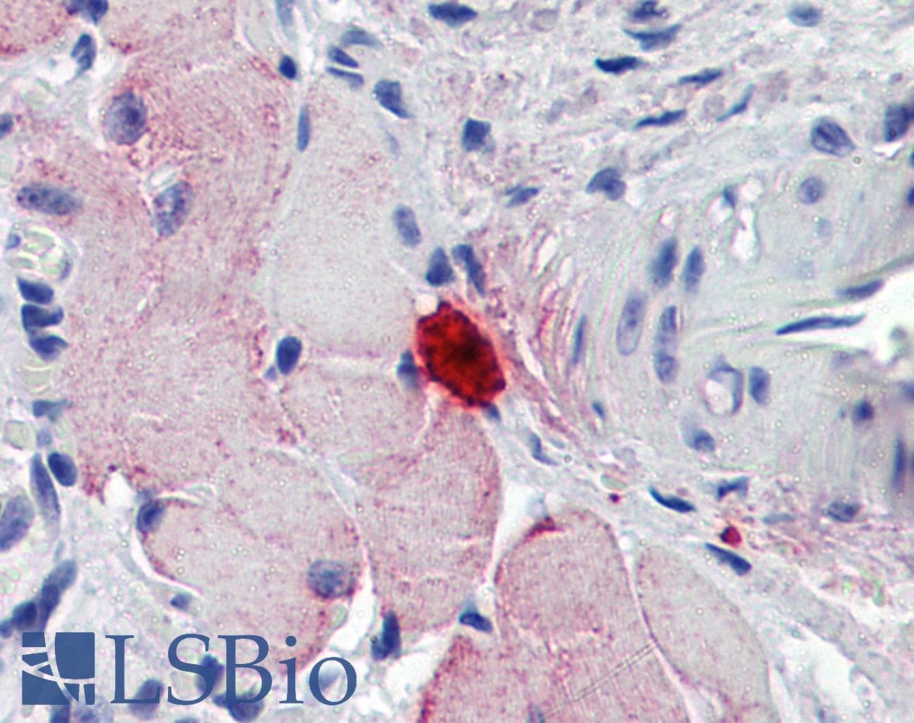 IHC-plus™ Polyclonal Goat anti-Mouse Mcpt4 Antibody (aa114-126, IHC)