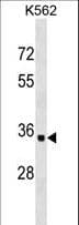 OR10AD1 Antibody (aa149-177)