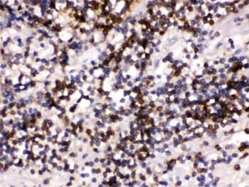 Polyclonal Rabbit anti-Human CD22 Antibody (IHC, WB)