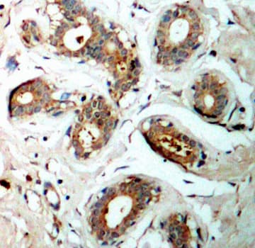 Polyclonal Rabbit anti-Human YWHAZ / 14-3-3 Zeta Antibody (phospho-Ser58, IHC, IF, WB)