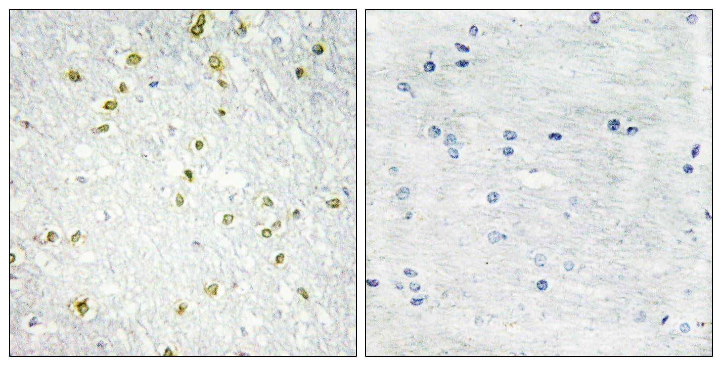 SNAPC5 Antibody (aa10-59)