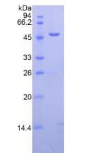 Human LAMP2 / CD107b Protein (Recombinant His-GST)