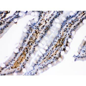 HSPA2 Antibody (aa564-598)