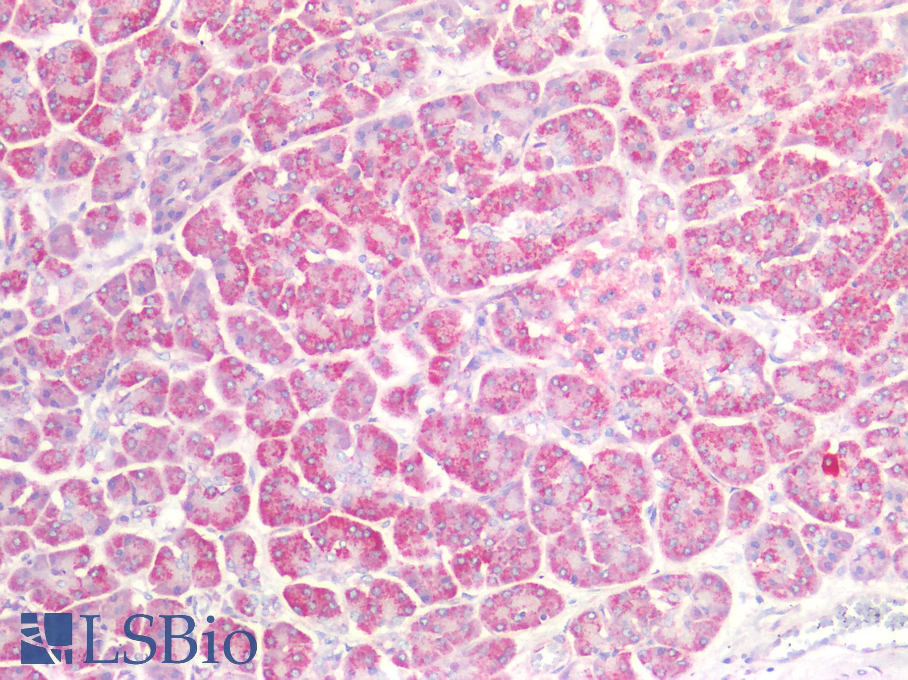 PathPlus™ Polyclonal Rabbit anti-Human RAB7A / RAB7 Antibody (IHC)