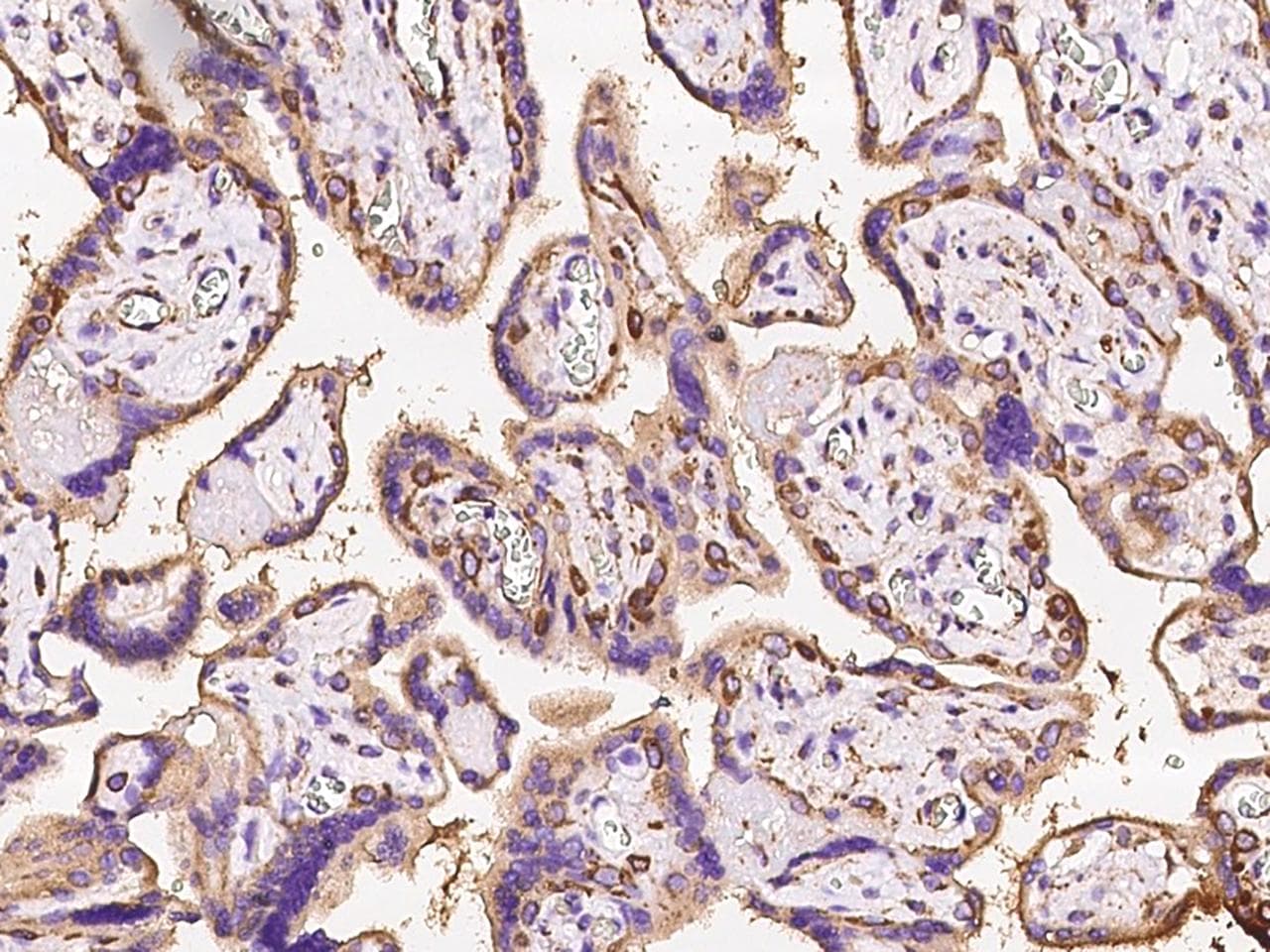 Polyclonal Rabbit anti-Human CALR / Calreticulin Antibody (IHC)