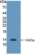 S100B / S100 Beta Antibody (aa1-92, Biotin)