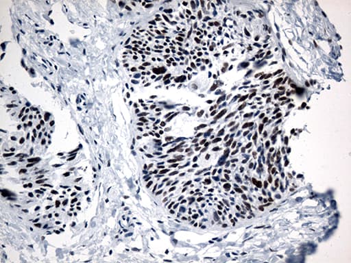GTF3C4 Antibody (aa583-822, clone OTI3D4)
