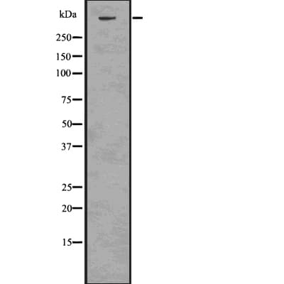 Polyclonal Rabbit anti-Human ATR Antibody (phospho-Ser428, IHC, WB)