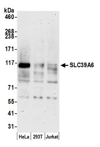SLC39A6 / LIV-1 Antibody (aa100-150)