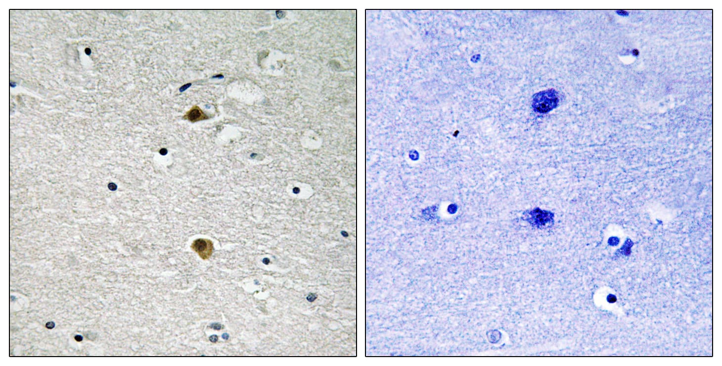 RELA / NFKB p65 Antibody (aa247-296)