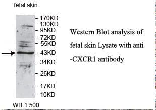 CXCR1 Antibody (N-Terminus)