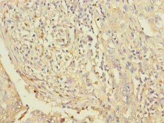 LPIN1 / Lipin 1 Antibody
