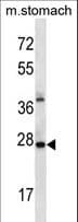 ALKBH4 Antibody (aa88-117)