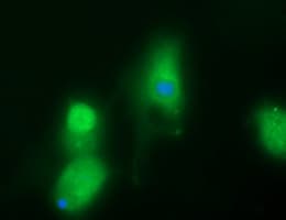 B3GNT2 Antibody (clone OTI1G10)