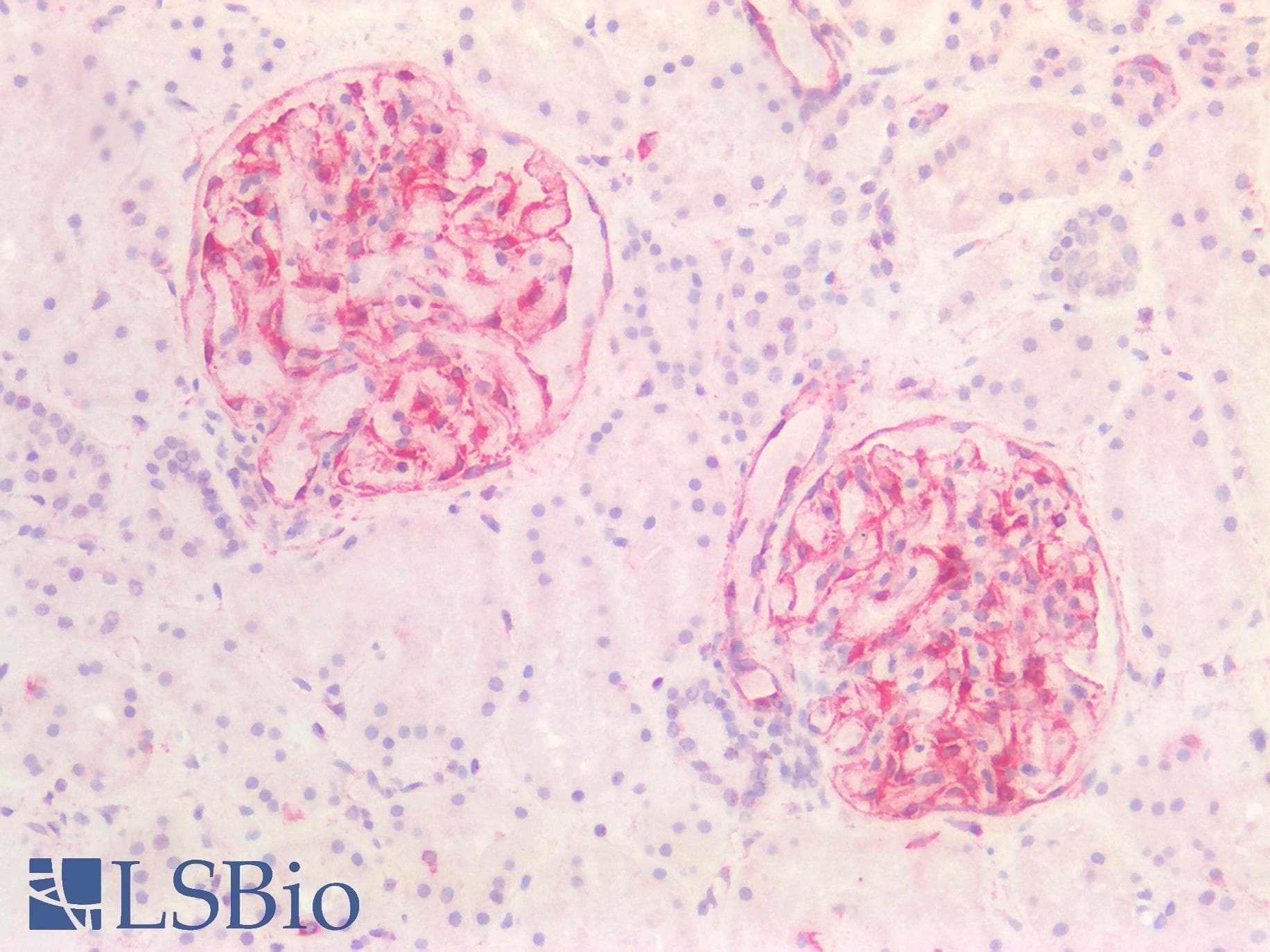 PathPlus™ Vimentin Antibody