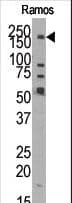 KDM3B / JMJD1B Antibody (aa25-57)