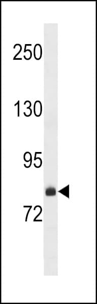 Polyclonal Rabbit anti-Human Carom / FCHSD2 Antibody (aa706-734, WB)
