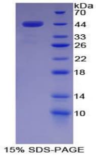 Pig Complement C7 Protein (Recombinant His-GST)