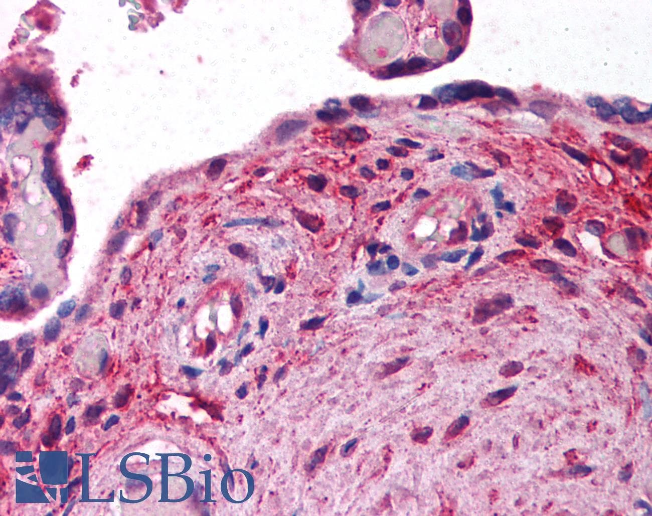 IHC-plus™ Polyclonal Rabbit anti-Human VG5Q / AGGF1 Antibody (aa500-600, IHC)