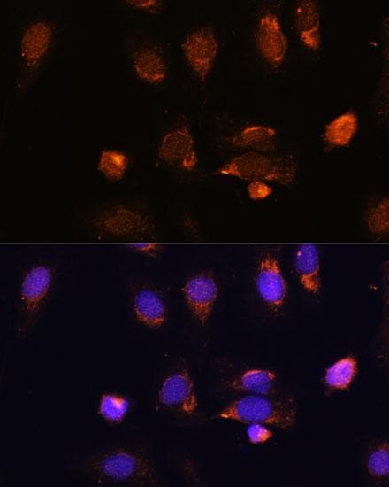 Polyclonal Rabbit anti-Human RPL34 / Ribosomal Protein L34 Antibody (IF)