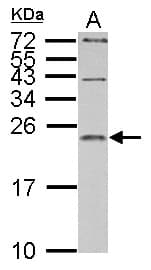 IL1RN Antibody (aa1-177)