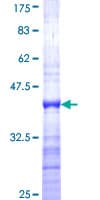 Human BF1 / FOXG1 Protein (Recombinant GST, N-terminus)