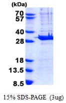 Human PYCRL Protein (Recombinant His)