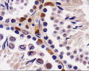 STK33 Antibody (aa1-150)